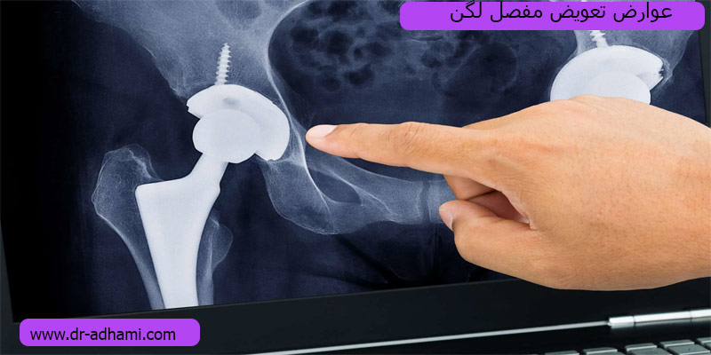 عوارض-مفصل-لگن