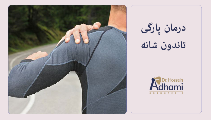 درمان پارگی تاندون شانه