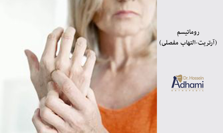 روماتیسم