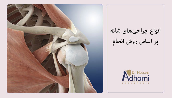 انواع-جراحی‌های-شانه-بر-اساس-روش-انجام