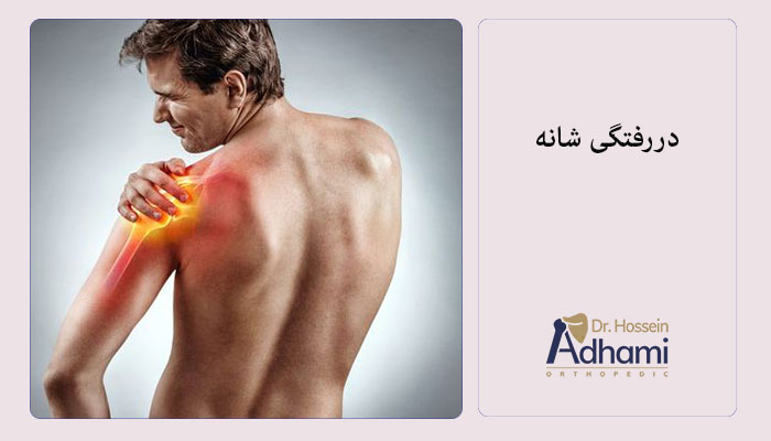 دررفتگی-شانه