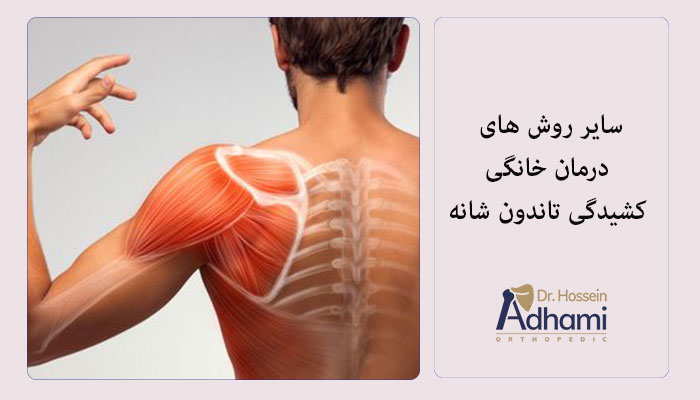 سایر-روش-های-درمان-خانگی-کشیدگی-تاندون-شانه