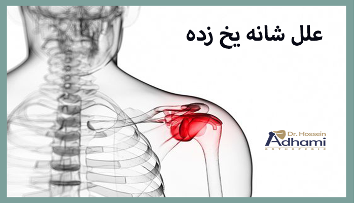 علل-شانه-یخ-زده