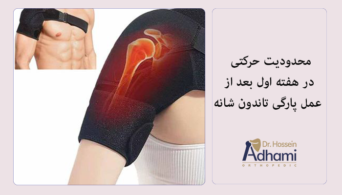 مرافبت های حرکتی بعد از عمل پاره شدن تاندون شانه