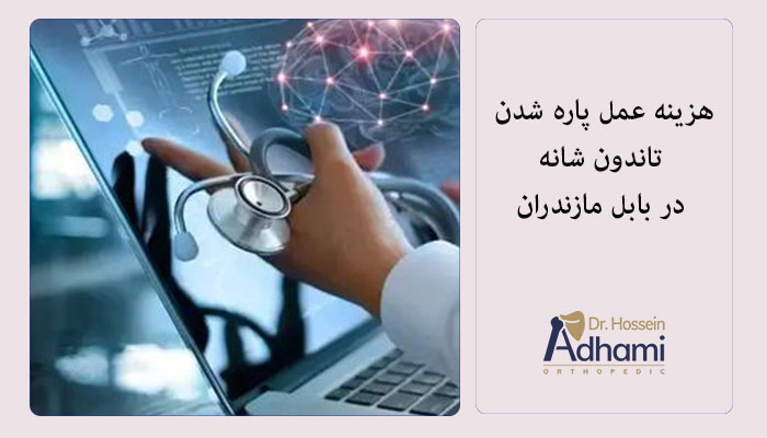 هزینه-عمل-پاره-شدن-تاندون-شانه