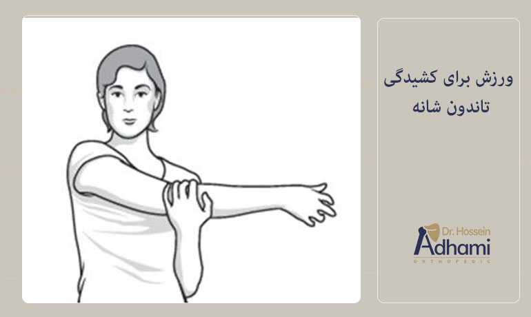 ورزش-برای-کشیدگی-تاندون-شانه