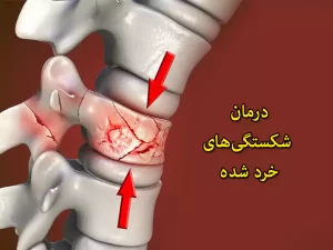 شکستگی‌های خرد شده