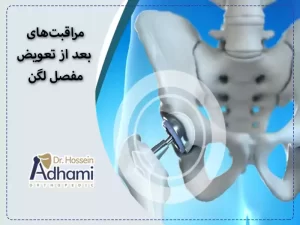 مراقبت‌های بعد از تعویض مفصل لگن