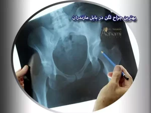 بهترین جراح لگن در بابل مازندران
