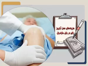 هزینه‌ عمل آرتروز زانو در بابل مازندران