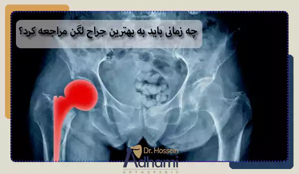 چه زمانی باید به بهترین جراح لگن مراجعه کرد؟