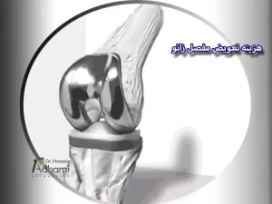 هزینه تعویض مفصل زانو در بابل مازندران